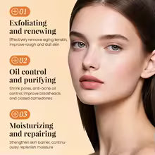 Remove Acne Fade Acne Glycolic Acid 7% Toner Removing Closed Mouth Acne Moisturizing Skin Prevents Skin Aging Fruit Acid Essence